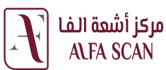 الفا